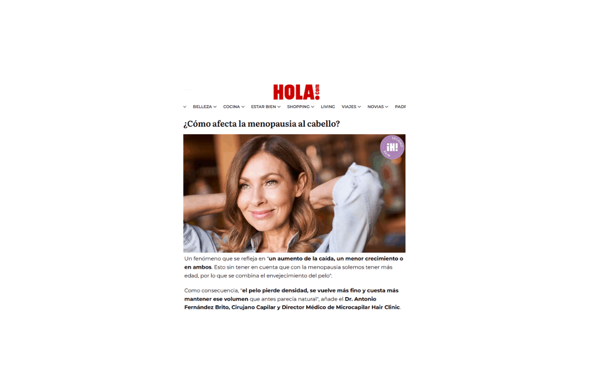 Prensa Villarrazo Web Casos Exito_Revista Hola Microcapilar Hair Clinic